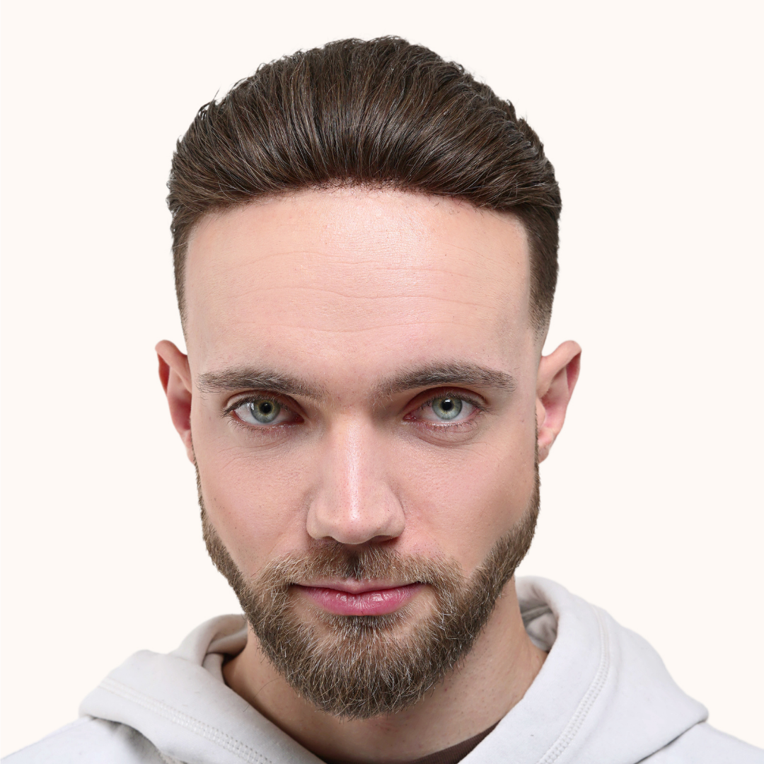 Hair Replacement System vs Hair Transplant