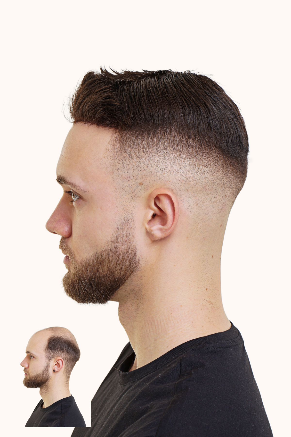 NewFade Cambridge Quiff hair system: Side view