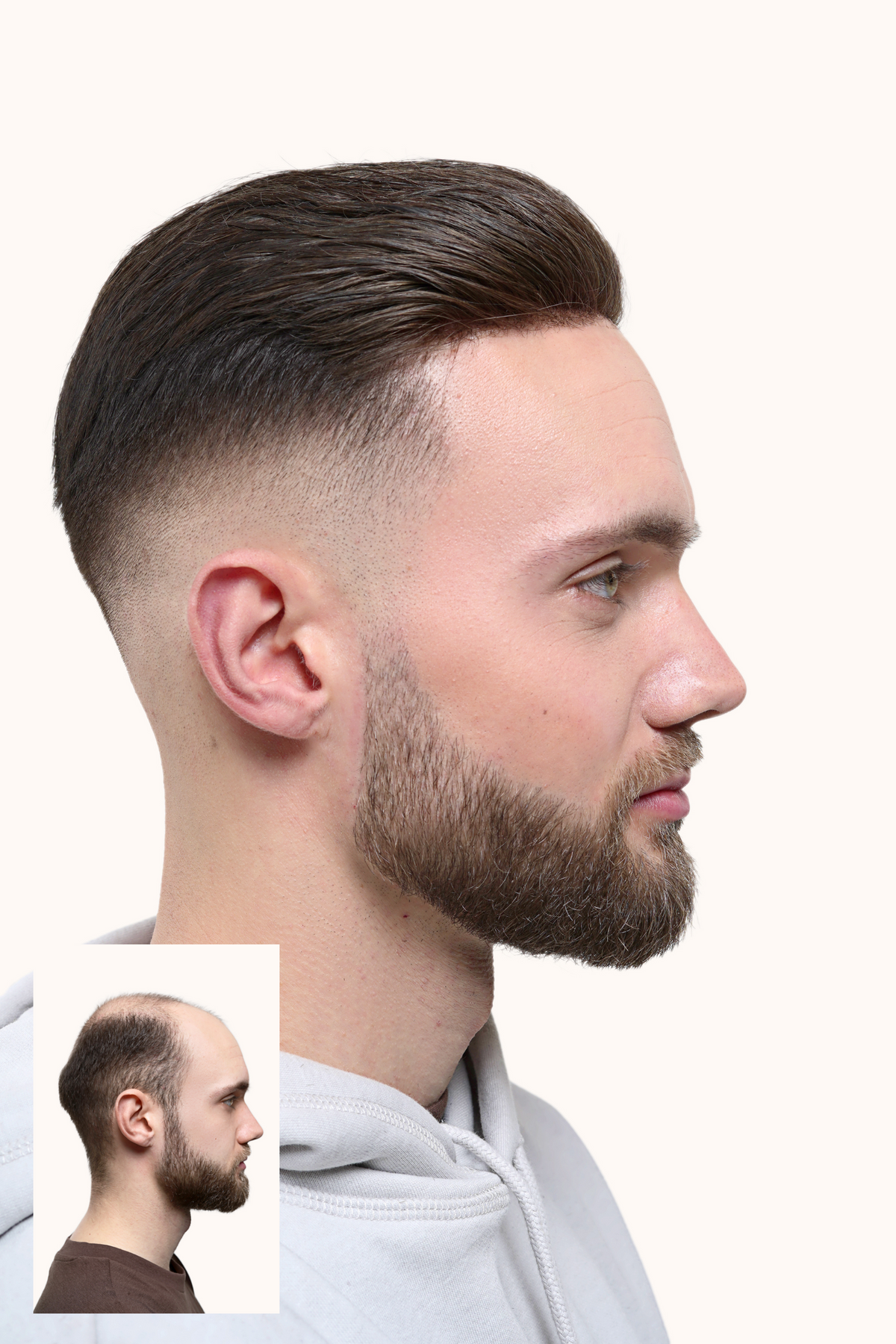 NewFade Classic Slick Back hair system: side view